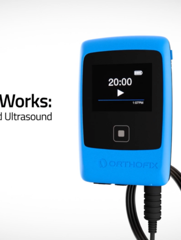 How LIPUS Works Spanish Video
